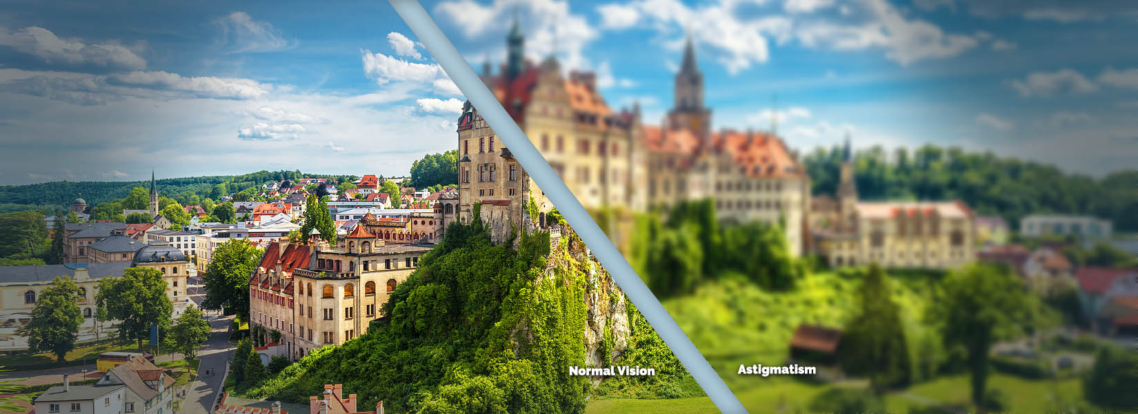 Astigmatism Treatment in Concord