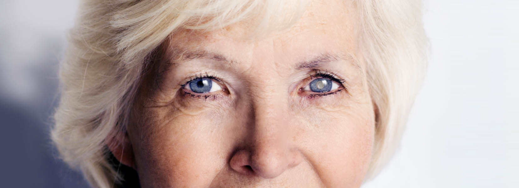 Cataract Surgery in Concord